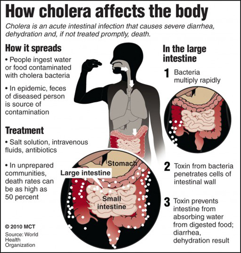 cholera-poster-sml-brd.jpg