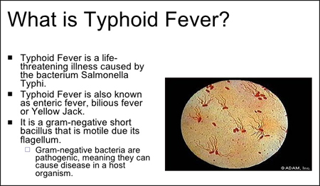 typhoid-fever-2-728-sml